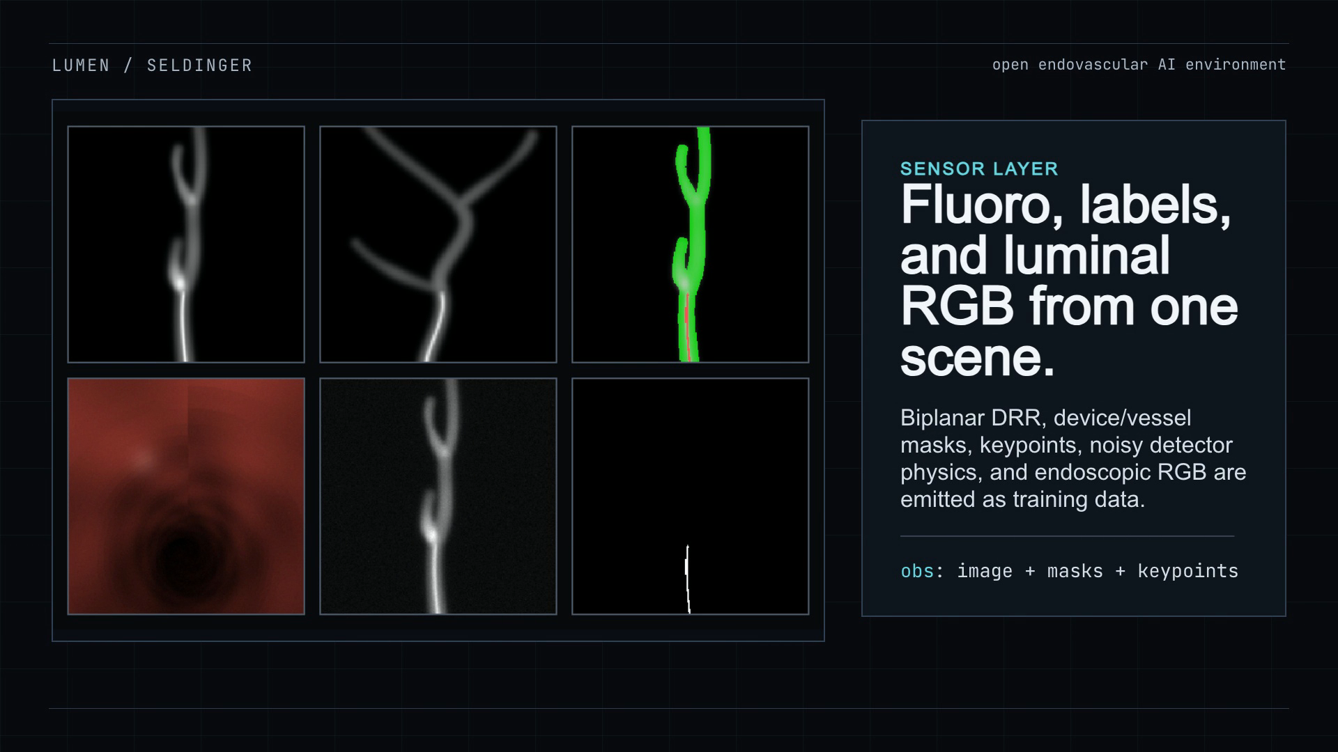 Lumen fluoroscopy, masks, and luminal sensor outputs